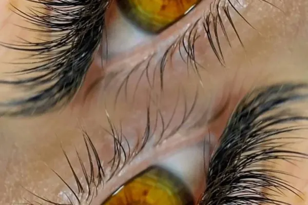 Lash_medik